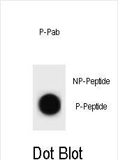 6 - Phospho-CCNB2(T359) Antibody AP3840a