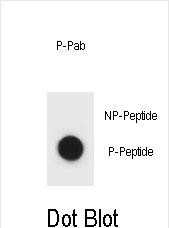 6 - Phospho-IKKB(S177) Antibody AP3845a