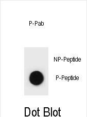 6 - Phospho-CCNB2(S11) Antibody AP3883a