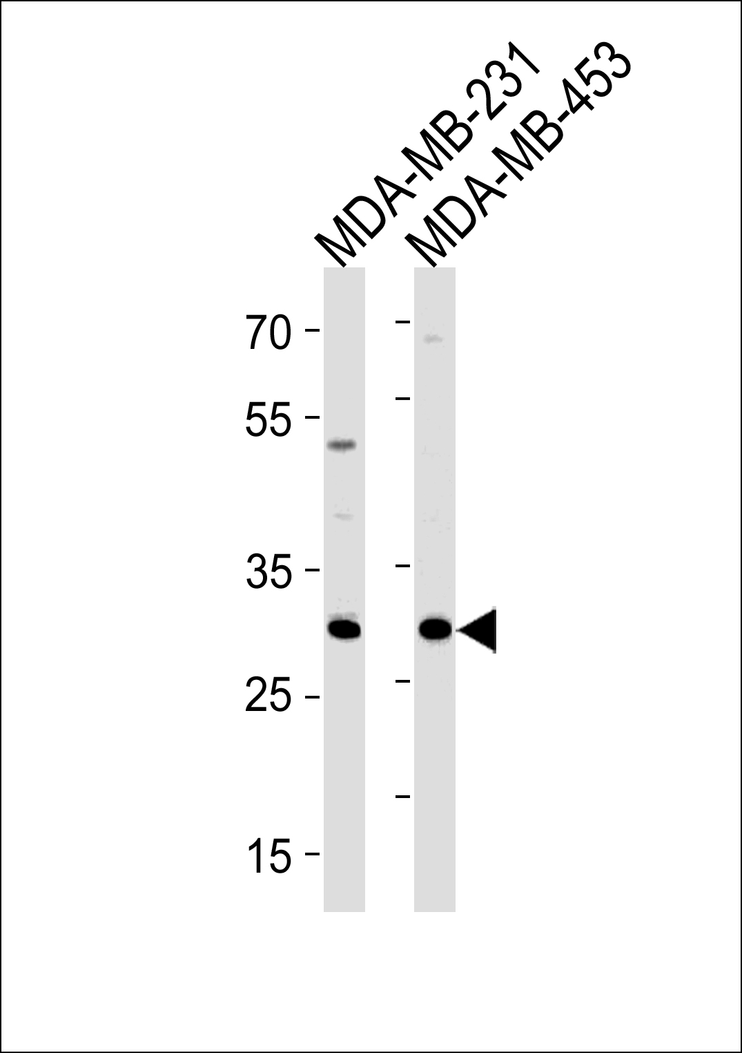 1 - ASB11 Antibody (N-term) AP20314a