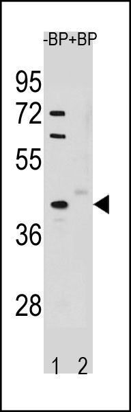 1 - STK25 Antibody (C-term) AP20345b