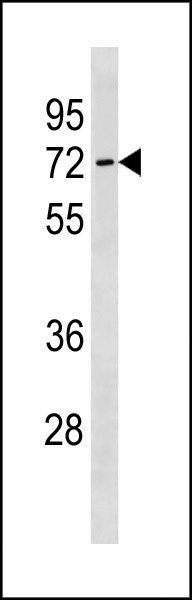 1 - SLC7A4 Antibody (C-term) AP20361b