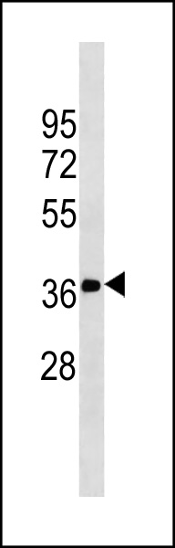 1 - FN3K Antibody (N-term)(Ascites) AM2193a