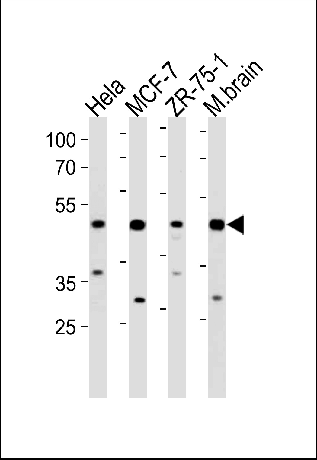 1 - FBXO28 Antibody (C-term) AP20438b