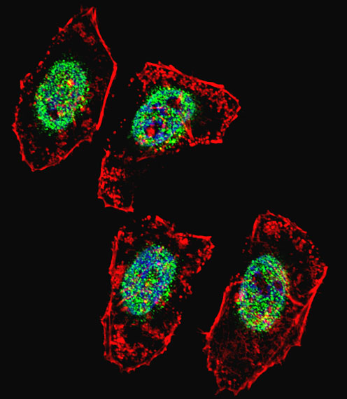 3 - HBO1/MYST2 Antibody (Center) AP1113c