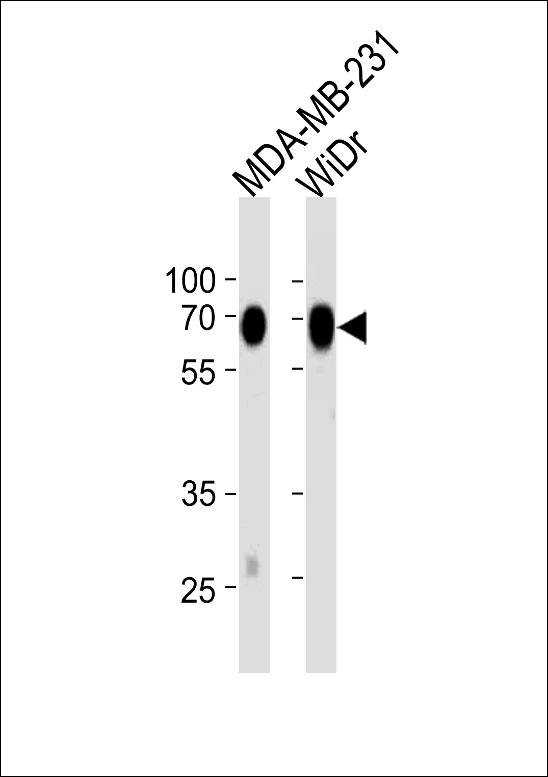1 - CD73(NT5E) Antibody (C-term)  [Knockdown Validated] AM2223a