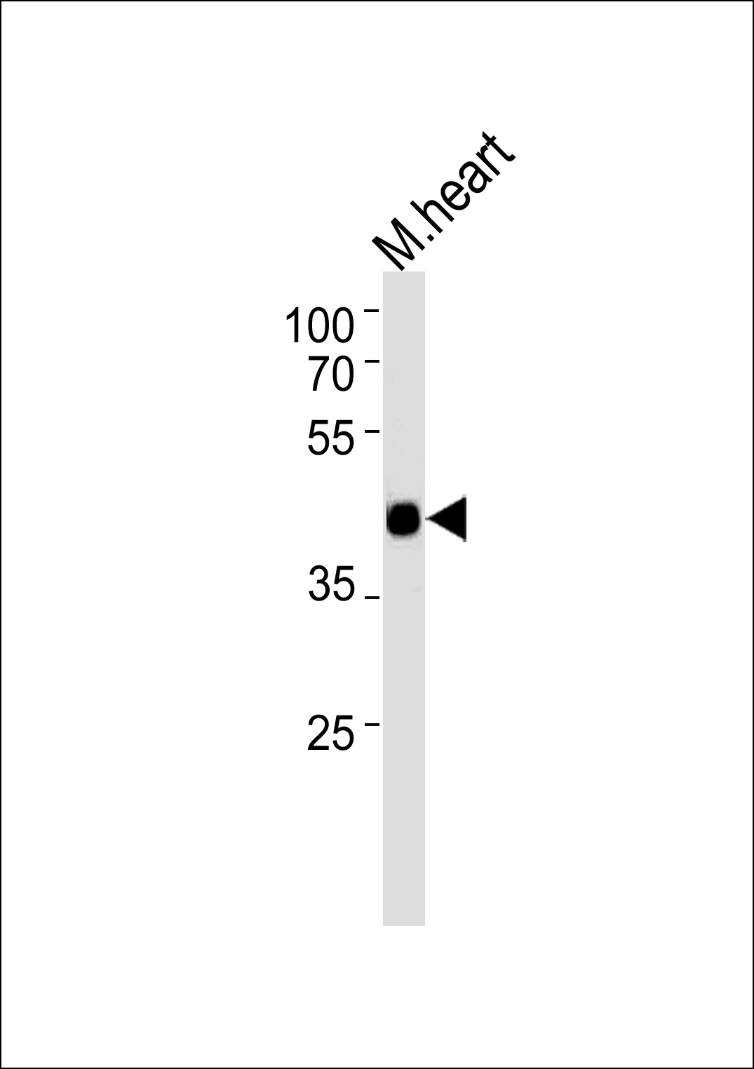 1 - M Tcfap2d Antibody (C-term) AP20493b