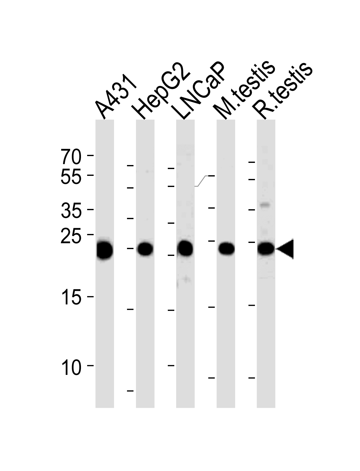 1 - TPI1 Antibody (C-term) AP2917b