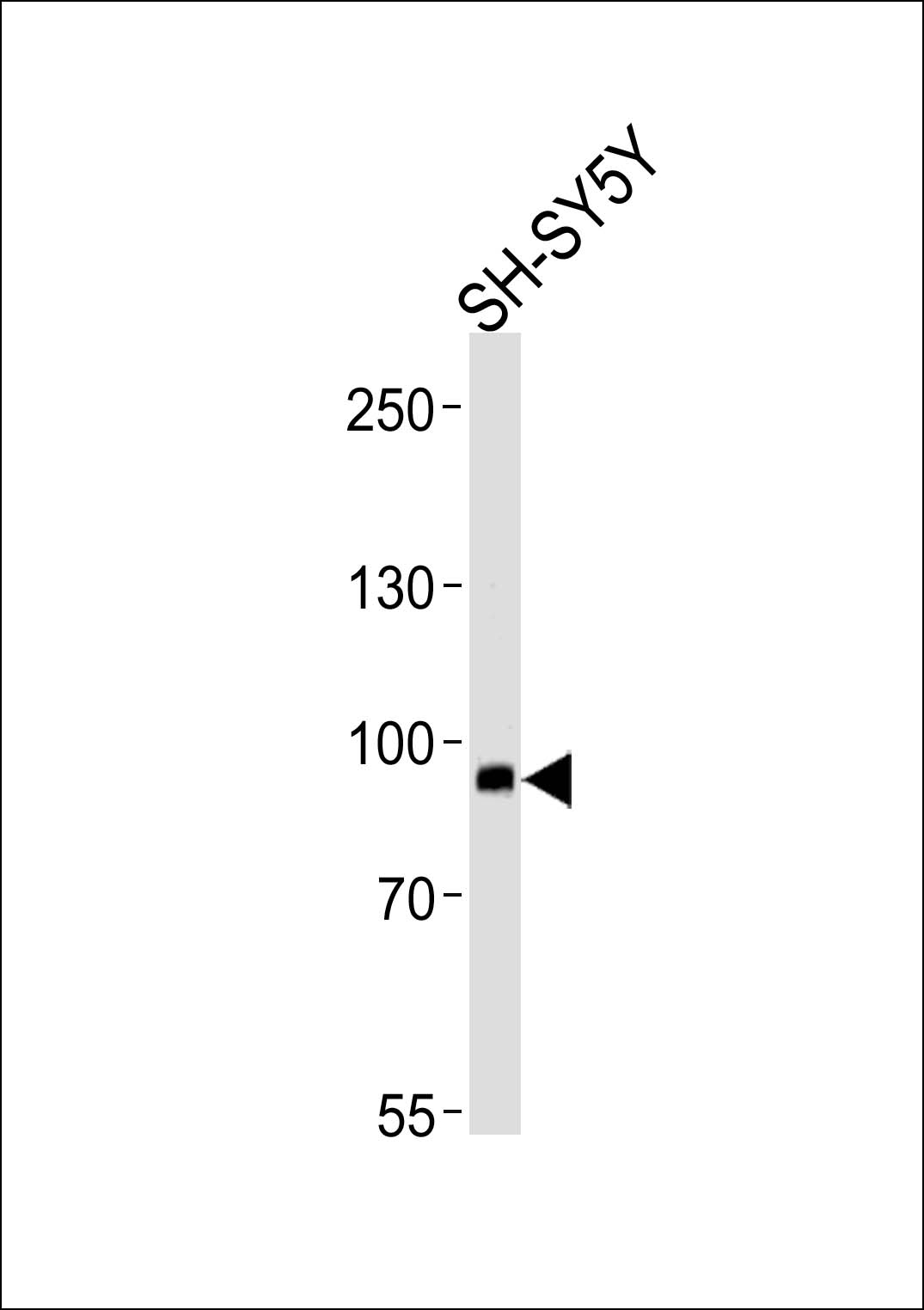 1 - PLA2G4E Antibody AP50044