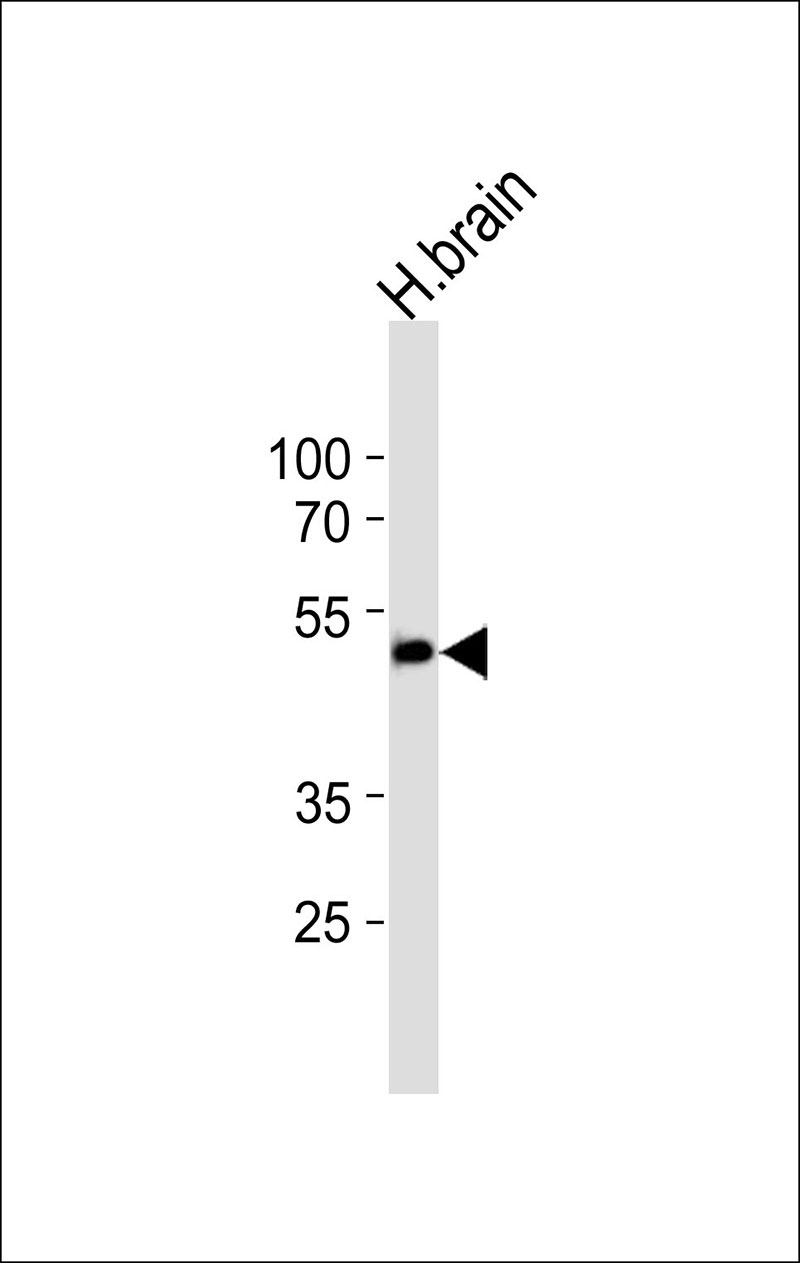1 - CHST10 Antibody AP50588