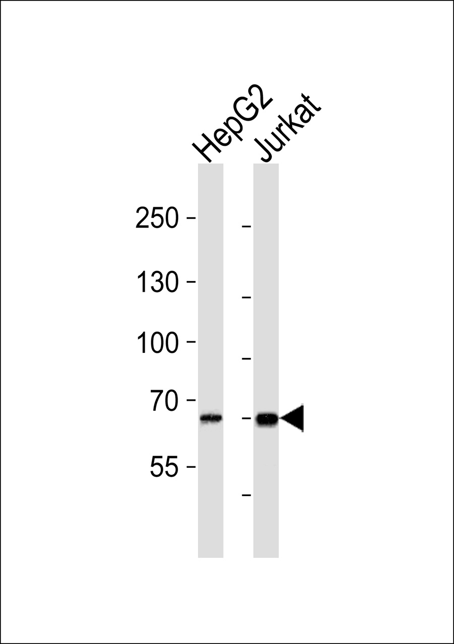 1 - SLC28A2 Antibody AP50592