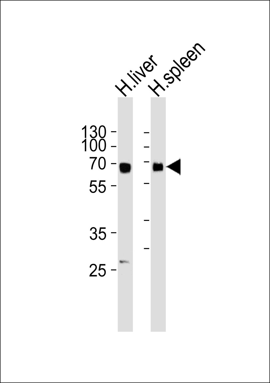 1 - GBA3 Antibody AP50623