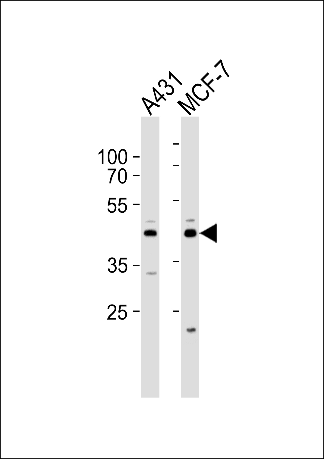 1 - IDH3G Antibody (N-term) AP20665a