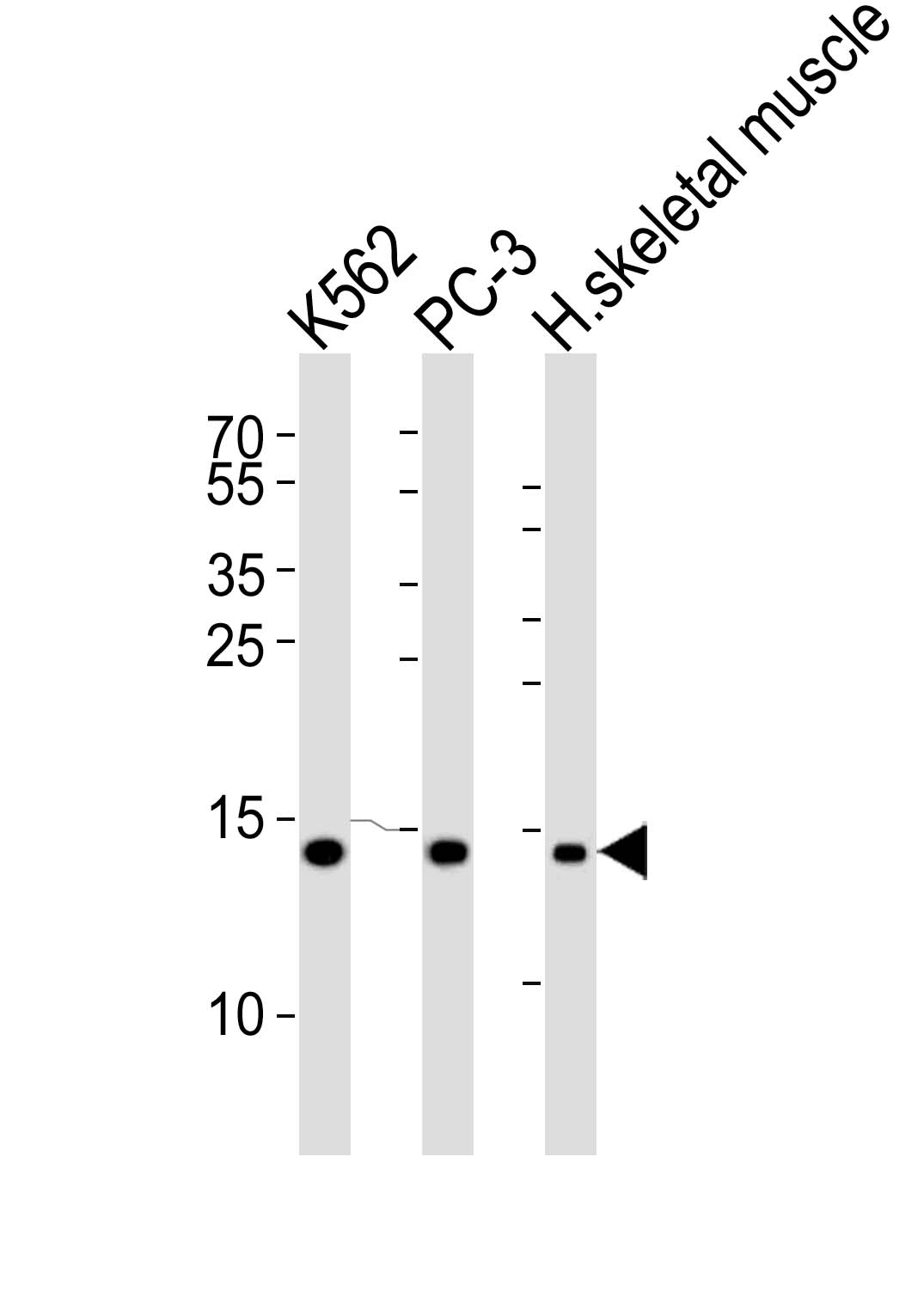 1 - HIST1H2BM Antibody (N-term) AP20679a