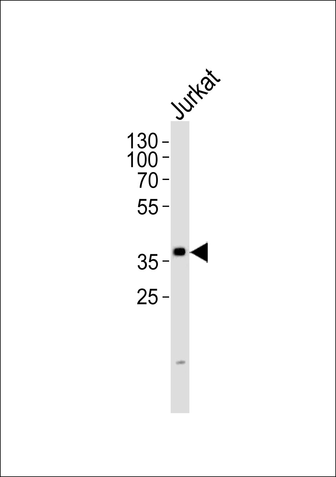 1 - TSTA3 Antibody AP50750