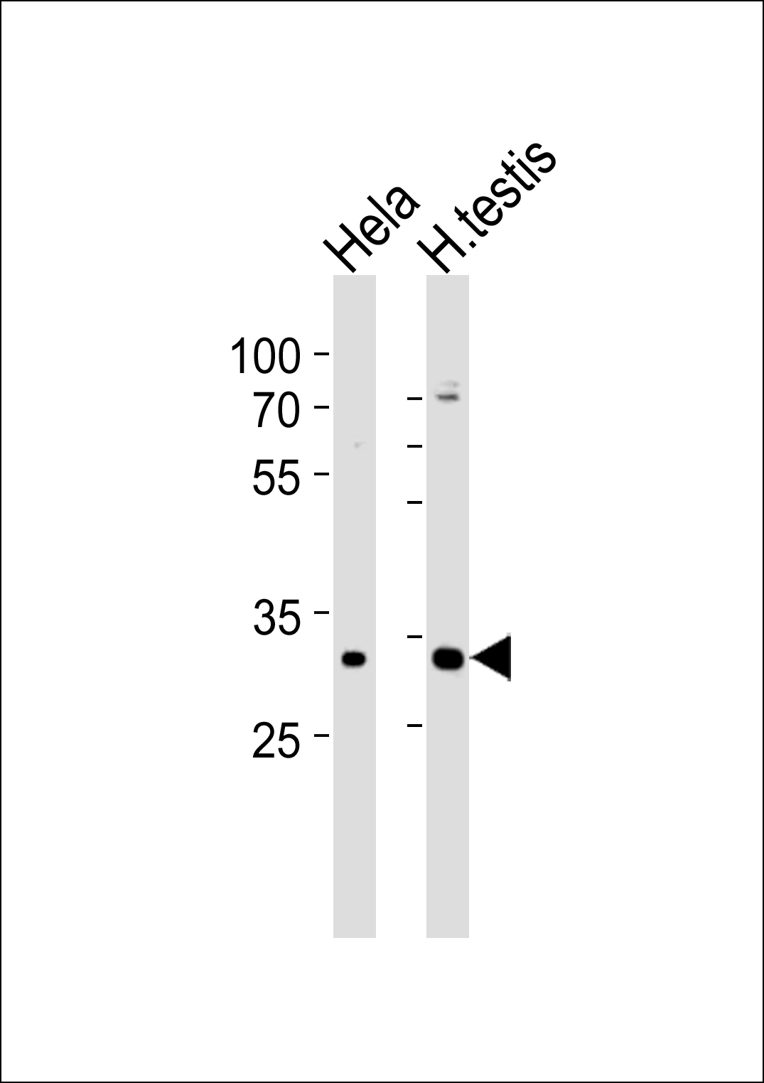 1 - MTX2 Antibody (Center) AP20787c
