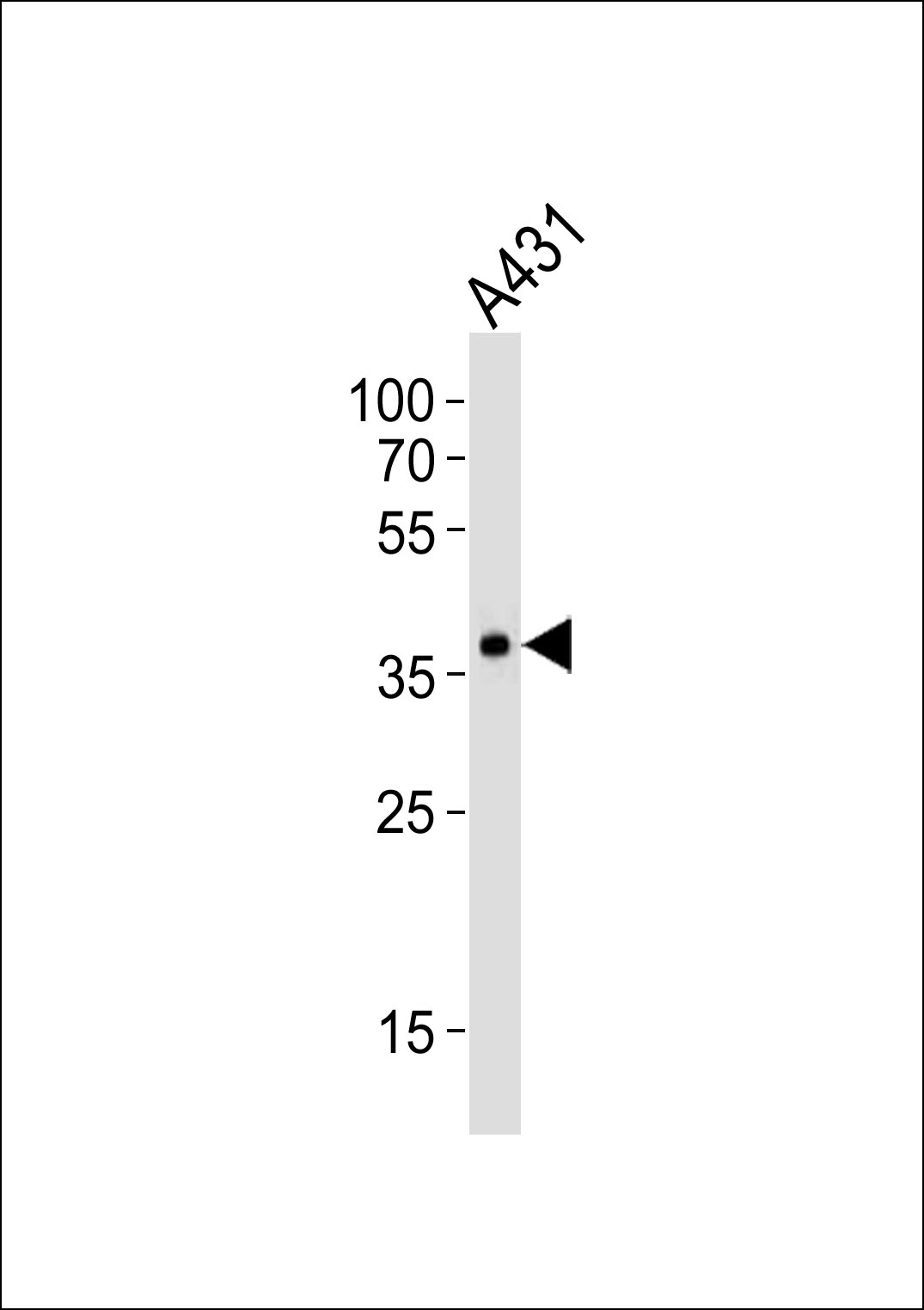 1 - MUL1 Antibody (Center) AP20808c