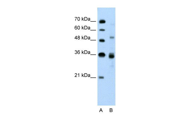 1 - TNRC4 antibody - N-terminal region AI10022