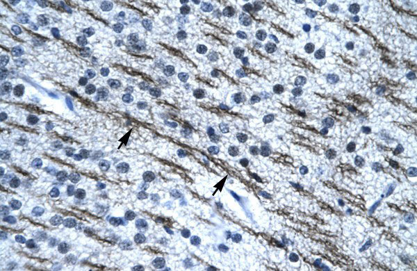 2 - SSBP2 antibody - N-terminal region AI10031