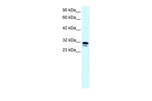 1 - SSBP2 antibody - N-terminal region AI10031