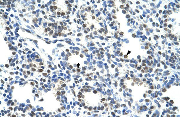 2 - CBX3 antibody - middle region AI10144