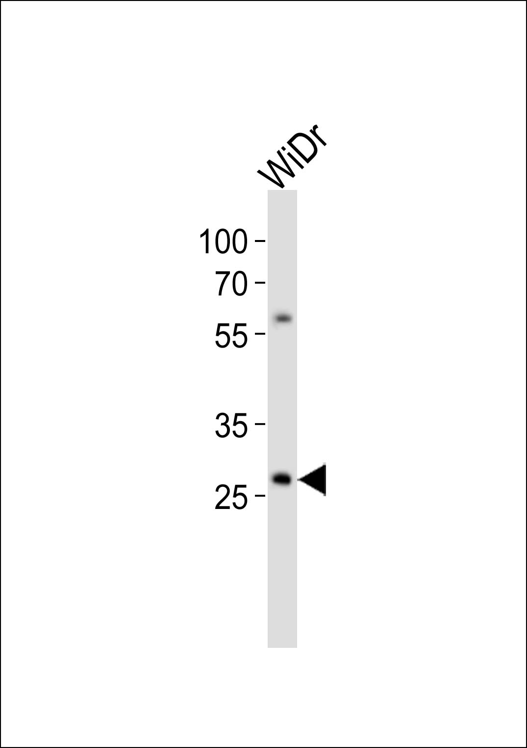1 - COX11 Antibody (C-term) AP20946c