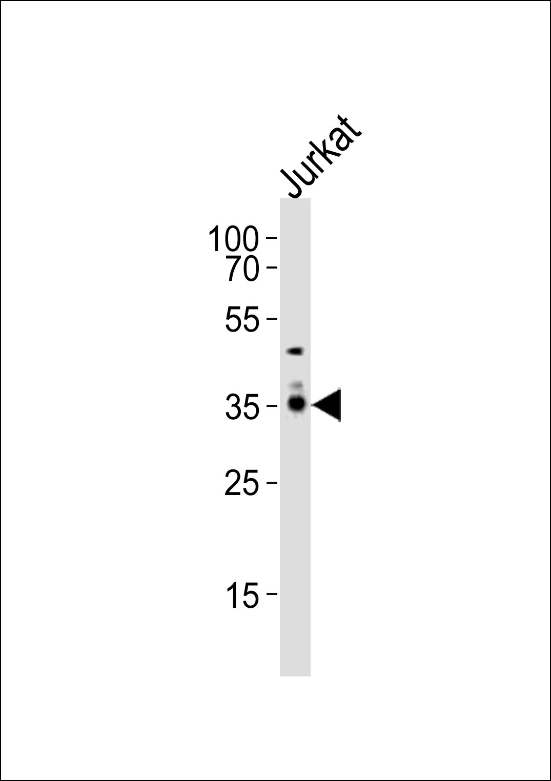 1 - PPAP2A Antibody (C-term) AP21024c