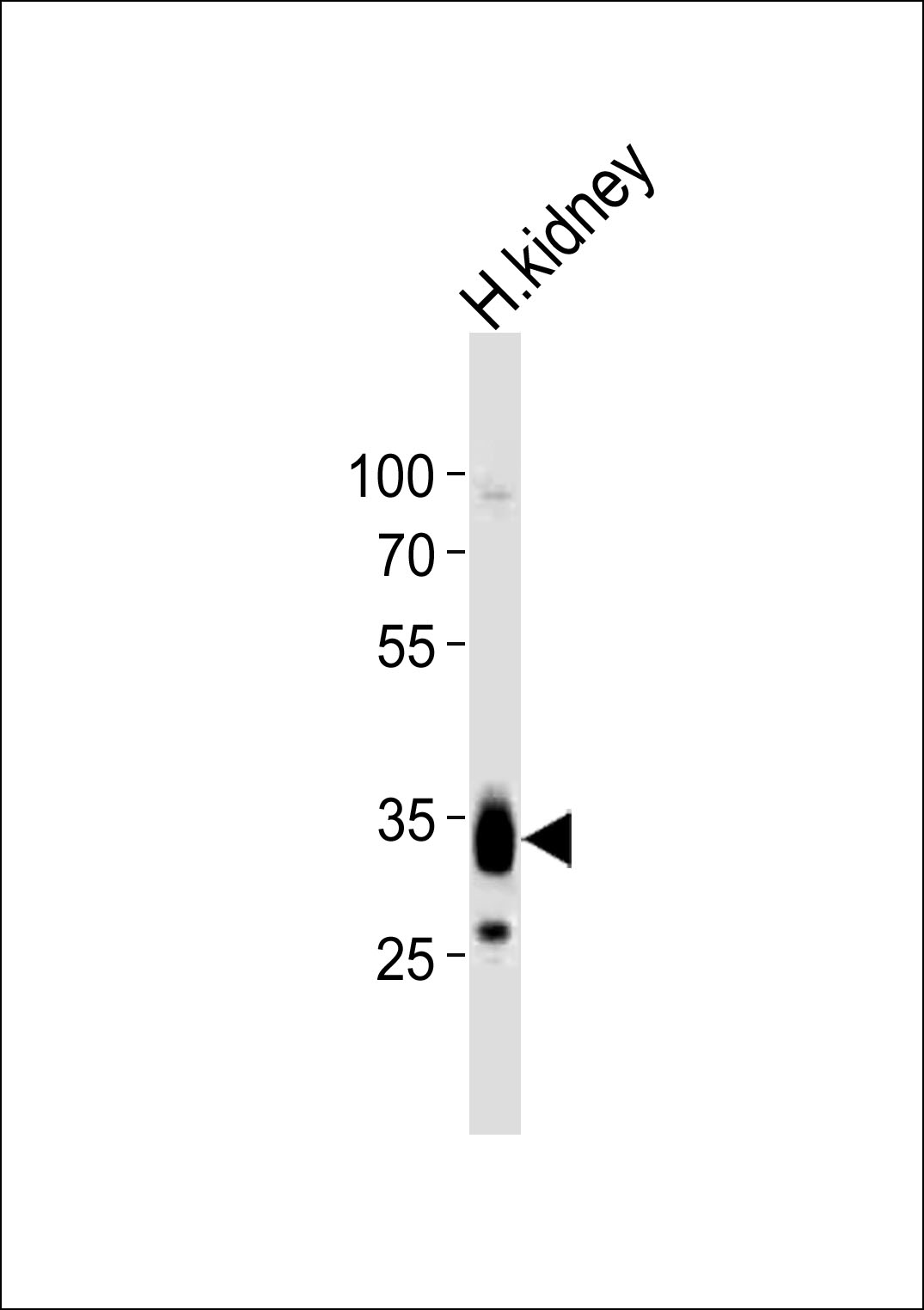 1 - PPAP2A Antibody (C-term) AP21024c