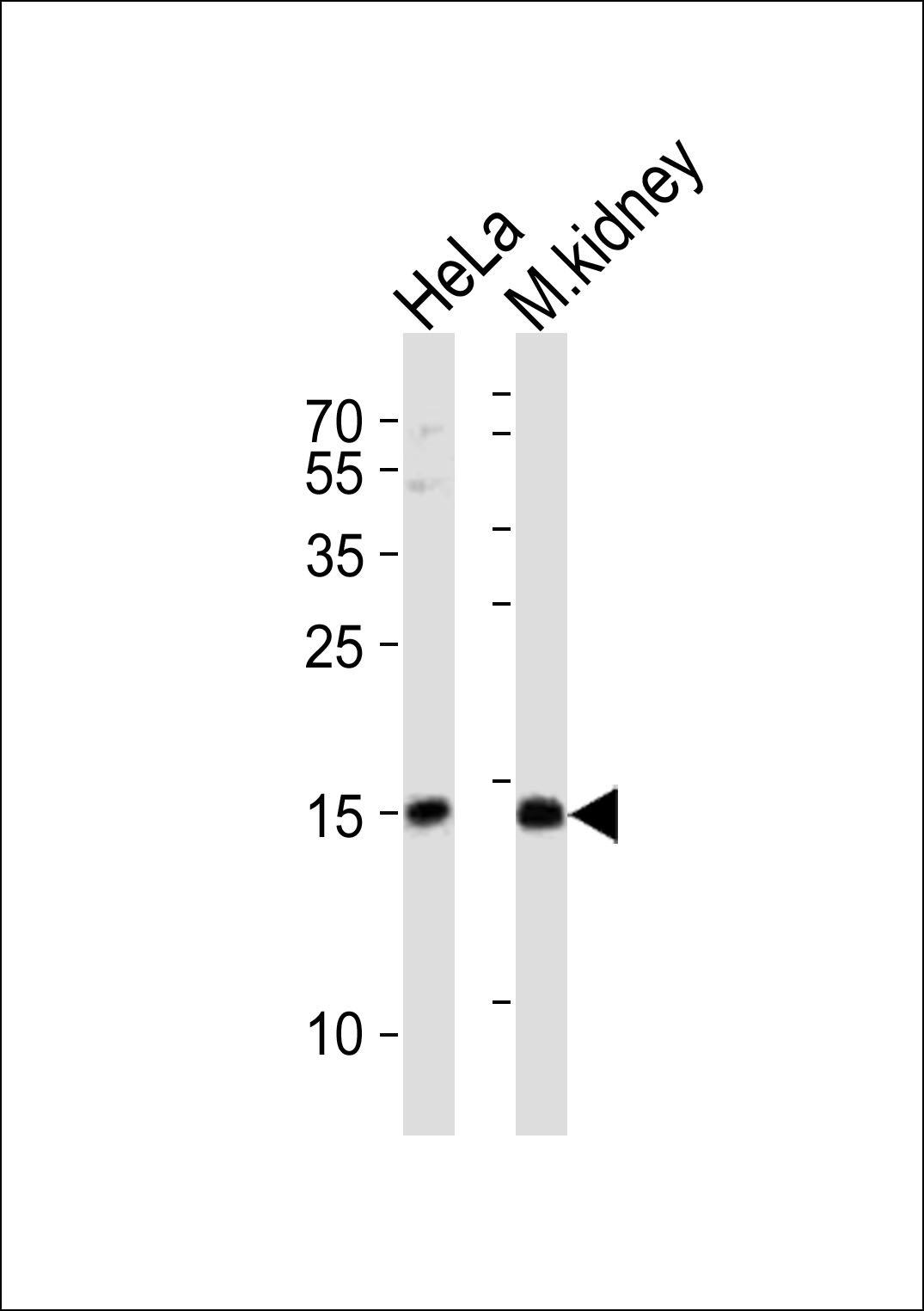 1 - CDA Antibody (C-term) AP2868b