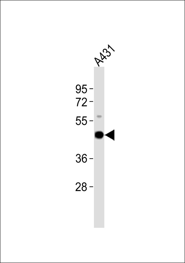 1 - Cytokeratin 18 Antibody AP51309
