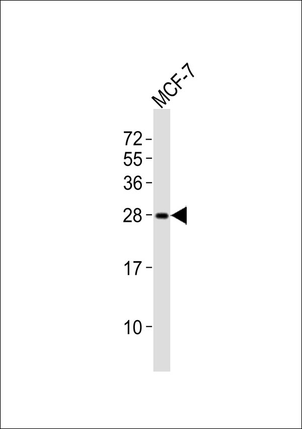 1 - RAB20 Antibody AP51462