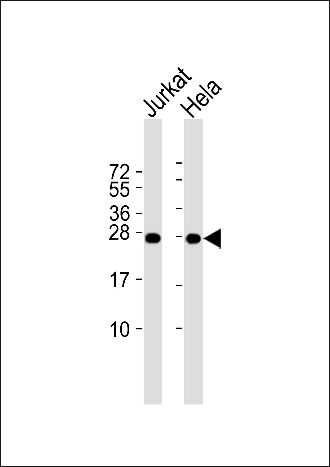 1 - RPL10 Antibody AP51481