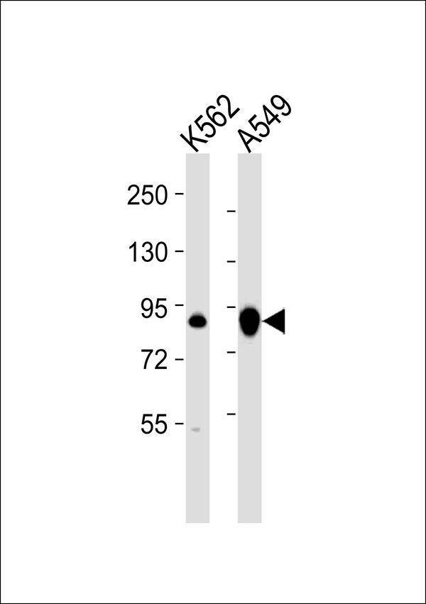 1 - Transglutaminase 2 Antibody AP51561