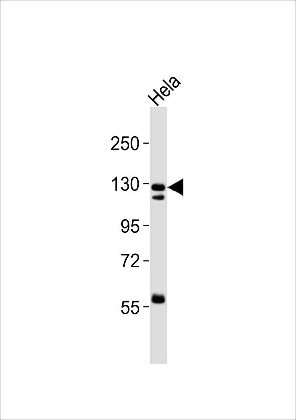 1 - Pyruvate Carboxylase Antibody AP51826
