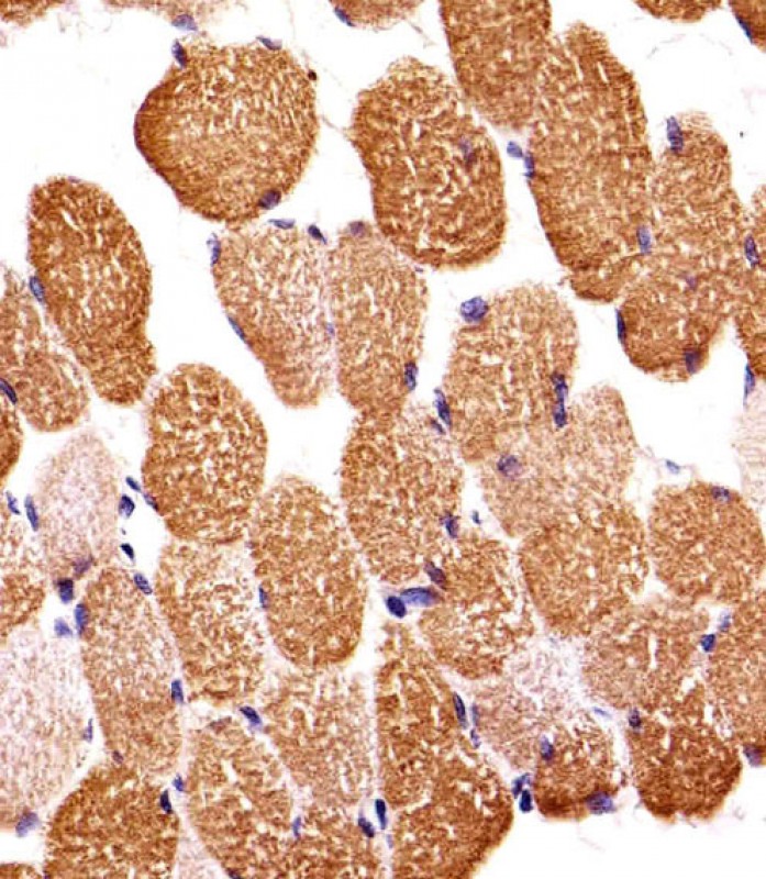 14 - SIRPB1 Antibody (N-term) AP20454a