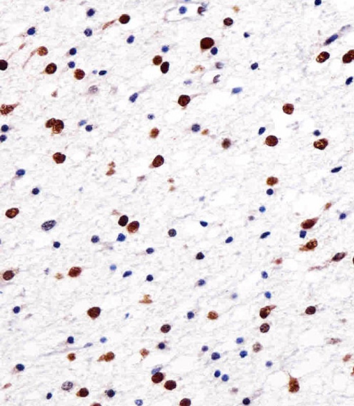 14 - NOVA1 Antibody (Center) AP20963a