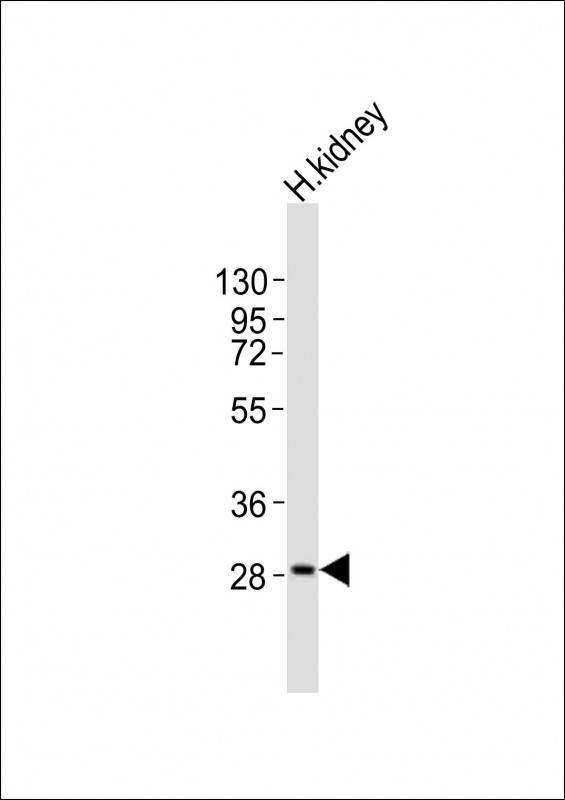 1 - PPAP2A Antibody (C-term) AP21319b