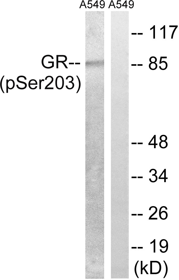 1 - GR (Phospho-Ser203) Antibody AP52488