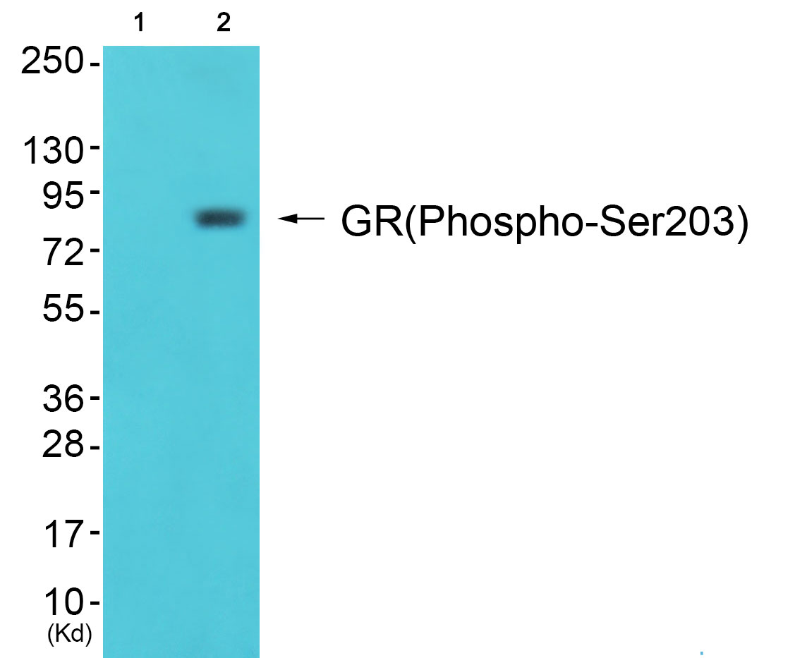1 - GR (Phospho-Ser203) Antibody AP52488