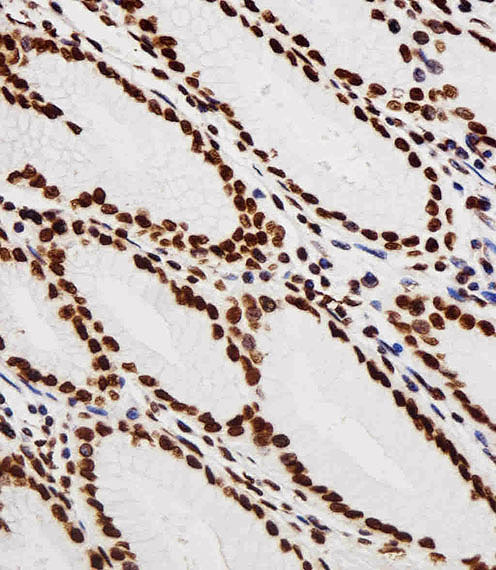 14 - HIST1H2AG Antibody (Center) AW5129