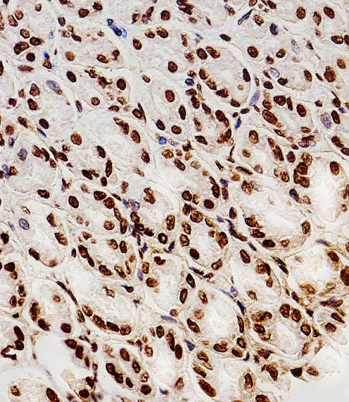 14 - HIST1H2AG Antibody (Center) AW5129