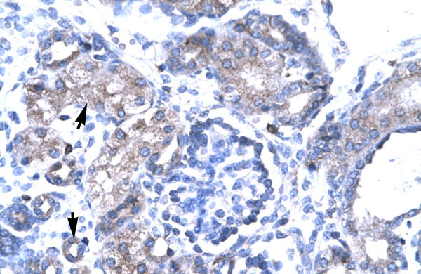 2 - TBX19 antibody - N-terminal region AI10348
