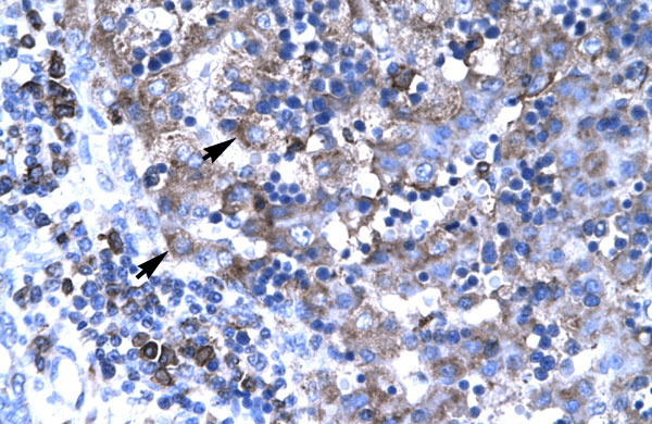 2 - TBX19 antibody - N-terminal region AI10348