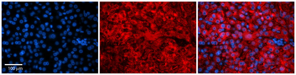 2 - Snf8 antibody - N-terminal region AI10426