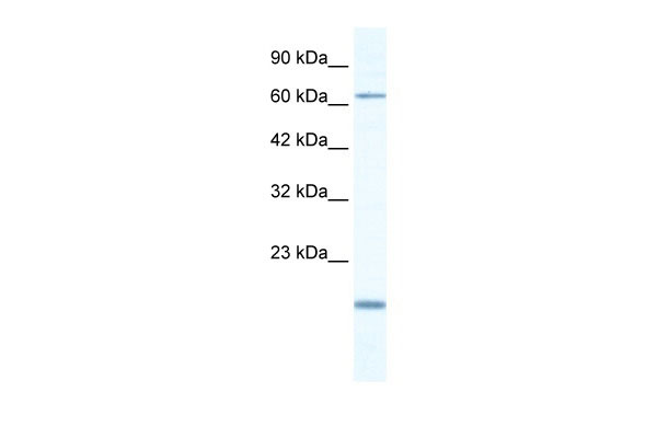 1 - TBX5 antibody - N-terminal region AI10507