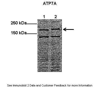 1 - ATP7A antibody - middle region AI10563
