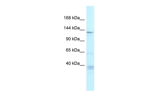 1 - Tnks antibody - middle region AI10591