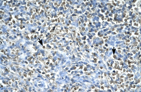 2 - ASGR2 antibody - N-terminal region AI10664