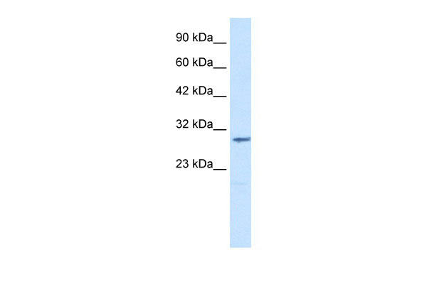 1 - CLIC2 antibody - middle region AI10780