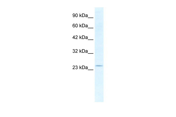 1 - SOX14 antibody - middle region AI10871
